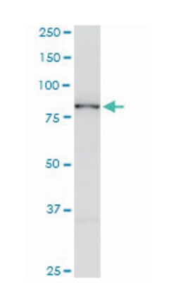 SMAD specific E3 ubiquitin protein ligase 1, Mouse, Clone: 1D7, Abnova