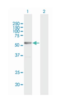 METTL4, Mouse, Polyclonal Antibody, Abnova 50&mu;g; Unlabeled:Antibodies,