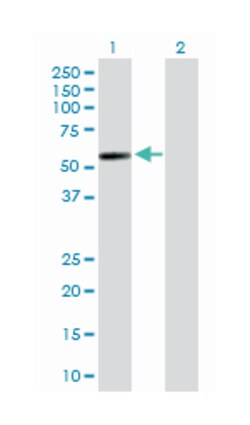 galactose-3-O-sulfotransferase 4, Rabbit, Purified MaxPab Polyclonal Antibody, Abnova 100 &mu;g | Buy Online | Abnova Corporation | Fisher Scientific