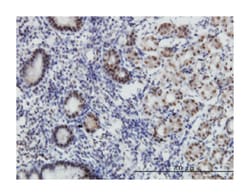 transcriptional adaptor 2 (ADA2 homolog, yeast)-beta, Mouse, Clone: 1C8,