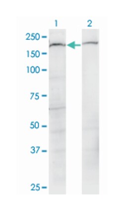 PLXNB2, Mouse, Clone: 2H3, Abnova 100 &mu;g | Buy Online | Abnova Corporation | Fisher Scientific