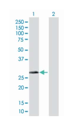 dehydrogenase/reductase (SDR family) member 4, Mouse, Polyclonal Antibody,
