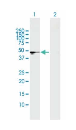 sphingomyelin phosphodiesterase, acid-like 3B, Mouse, Polyclonal Antibody, Abnova 50 &mu;L | Buy Online | Abnova | Fisher Scientific