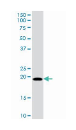 mitochondrial ribosomal protein L18, Mouse, Purified MaxPab Polyclonal Antibody, Abnova 50 &mu;g | Buy Online | Abnova Corporation | Fisher Scientific