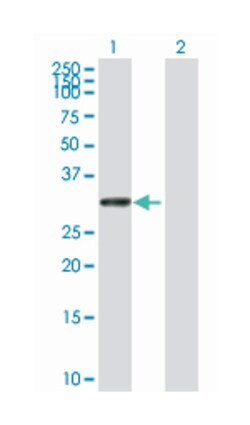 UTP11-like, U3 small nucleolar ribonucleoprotein, (yeast), Mouse, Purified