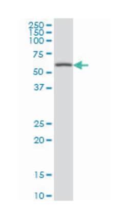 CABC1, Mouse, Clone: 5A4, Abnova 200&mu;L; Unlabeled:Antibodies, Monoclonal