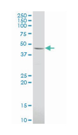 leucine rich repeat containing 2, Mouse, Polyclonal Antibody, Abnova 50 &mu;L | Buy Online | Abnova Corporation | Fisher Scientific