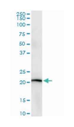 STMN2, Mouse, Clone: 2E3, Abnova 100&mu;g; Unlabeled:Antibodies, Monoclonal