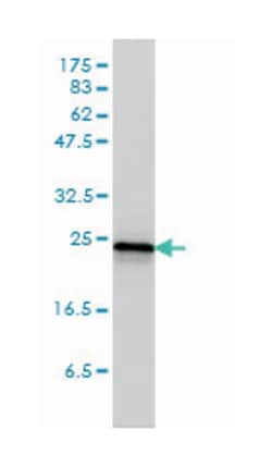 RRAS2, Mouse, Clone: 2D3-4B8, Abnova 200 &mu;L | Buy Online | Abnova Corporation | Fisher Scientific