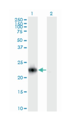 RRAS2, Mouse, Clone: 2D3-4B8, Abnova 200 &mu;L | Buy Online | Abnova Corporation | Fisher Scientific