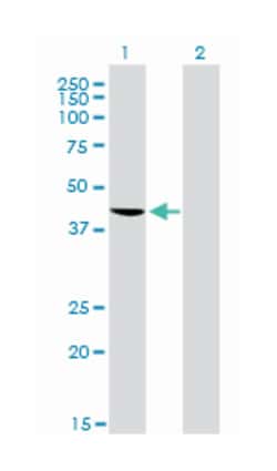 TAR DNA binding protein, Mouse, Clone: 2E2-D3, Abnova 100 &mu;g | Buy Online | Abnova Corporation | Fisher Scientific