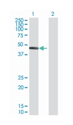 tripartite motif-containing 17, Mouse, Polyclonal Antibody, Abnova 50&mu;L;