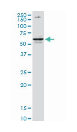 CSAD, Mouse, Clone: 2C11, Abnova 200&mu;L; Unlabeled:Antibodies, Monoclonal