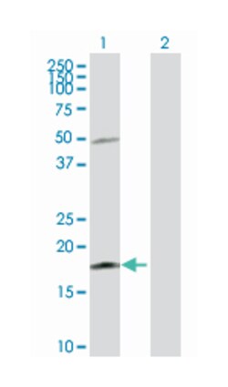 interleukin 21, Rabbit, Purified MaxPab Polyclonal Antibody, Abnova 100&mu;g;