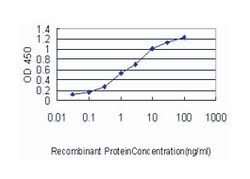 centromere protein M, Mouse, Clone: 4C12-2C8, Abnova 100&mu;g; Unlabeled:Antibodies,