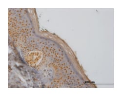 F-box protein 11, Mouse, Clone: 4C12, Abnova 100&mu;g; Unlabeled:Antibodies,