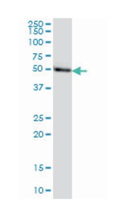 transcriptional adaptor 2 (ADA2 homolog, yeast)-beta, Mouse, Clone: 1C8,