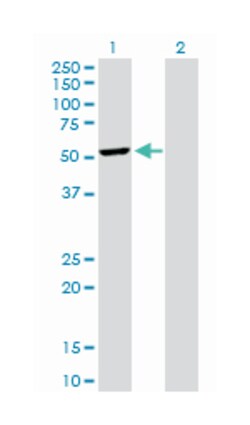 dynactin 2 (p50), Rabbit, Purified MaxPab Polyclonal Antibody, Abnova 100 &mu;g | Buy Online | Abnova | Fisher Scientific
