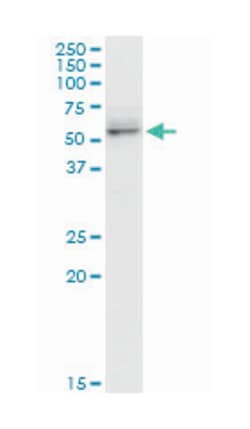 cell adhesion molecule 1, Mouse, Polyclonal Antibody, Abnova 50&mu;L; Unlabeled:Antibodies,