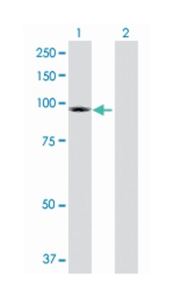 transient receptor potential cation channel, subfamily C, member 4 associated