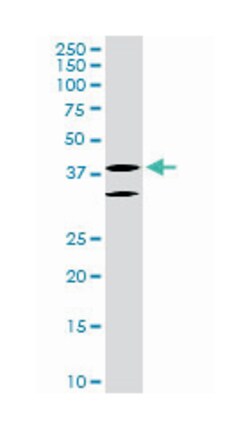 LIM homeobox 6, Mouse, Clone: 3E8, Abnova 100&mu;g; Unlabeled:Antibodies,