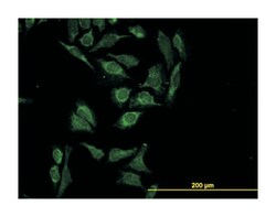 HTRA2, Mouse, Clone: 6H8, Abnova 100&mu;g; Unlabeled:Antibodies, Monoclonal