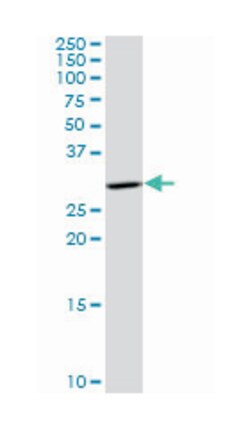 hydroxysteroid (17-beta) dehydrogenase 12 (A01), Mouse anti-Human, Polyclonal