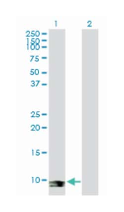 selenoprotein X, 1, Rabbit, Purified MaxPab Polyclonal Antibody, Abnova 100 &mu;g | Buy Online | Abnova Corporation | Fisher Scientific
