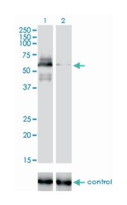 RAD18 homolog (S. cerevisiae), Mouse, Clone: 3H7, Abnova 100&mu;g; Unlabeled:Antibodies,