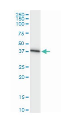 SRR, Rabbit, MaxPab Polyclonal Antibody, Abnova 100&mu;L; Unlabeled:Antibodies,