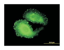 tensin 4, Mouse, Clone: 3B8, Abnova 100&mu;g; Unlabeled:Antibodies, Monoclonal