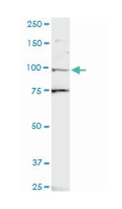 zinc finger protein 598, Mouse, Polyclonal Antibody, Abnova 50 &mu;L | Buy Online | Abnova Corporation | Fisher Scientific