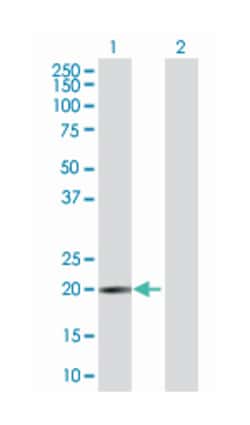 nudix (nucleoside diphosphate linked moiety X)-type motif 3, Mouse, Polyclonal