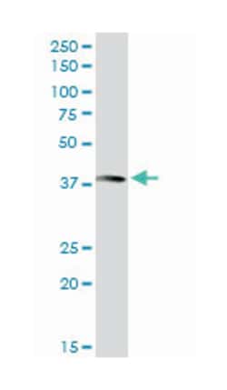 annexin A10, Rabbit, Purified MaxPab Polyclonal Antibody, Abnova 100&mu;g;