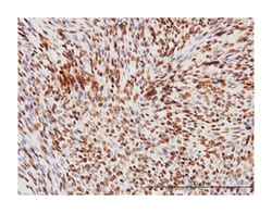 TAR DNA binding protein, Mouse, Clone: 2E2-D3, Abnova 100 &mu;g | Buy Online | Abnova Corporation | Fisher Scientific