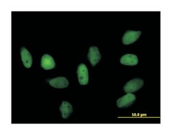 chromobox homolog 5 (HP1 alpha homolog, Drosophila), Rabbit, Purified MaxPab