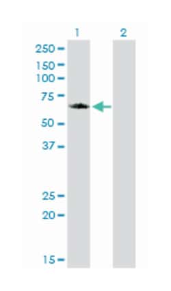 golgi associated, gamma adaptin ear containing, ARF binding protein 1,