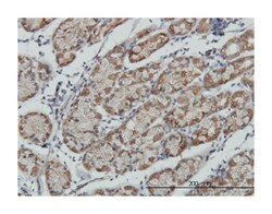 ribosomal protein S6 kinase, 90kDa, polypeptide 6, Mouse, Clone: 6F2, Abnova 100 &mu;g | Buy Online | Abnova | Fisher Scientific