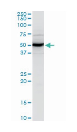 abhydrolase domain containing 5, Mouse, Polyclonal Antibody, Abnova 50&mu;L;