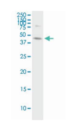 abhydrolase domain containing 5, Mouse, Clone: 1F3, Abnova 100&mu;g; Unlabeled:Antibodies,