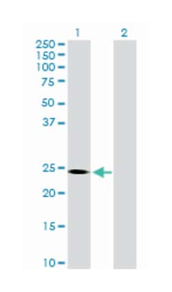 spermatogenesis and oogenesis specific basic helix-loop-helix 2, Mouse, Purified MaxPab Polyclonal Antibody, Abnova 50 &mu;g | Buy Online | Abnova Corporation | Fisher Scientific