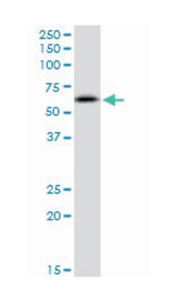 RNF25, Mouse, Polyclonal Antibody, Abnova 50&mu;L; Unlabeled:Antibodies,