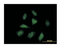 ISG20L1, Mouse, Purified MaxPab Polyclonal Antibody, Abnova 50 &mu;g | Buy Online | Abnova Corporation | Fisher Scientific