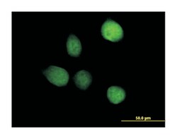 TSEN2, Mouse, Purified MaxPab Polyclonal Antibody, Abnova 50&mu;g; Unlabeled:Antibodies,