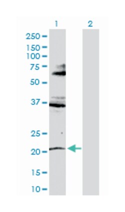 RNF135, Rabbit, Polyclonal Antibody, Abnova 100 &mu;g | Buy Online | Abnova Corporation | Fisher Scientific