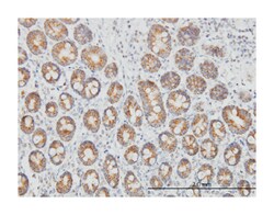 translocase of outer mitochondrial membrane 20 homolog (yeast), Mouse,