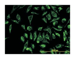 translocase of outer mitochondrial membrane 20 homolog (yeast), Mouse,