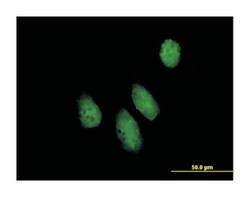 nucleoporin like 1, Mouse, Purified MaxPab Polyclonal Antibody, Abnova 50 &mu;g | Buy Online | Abnova | Fisher Scientific