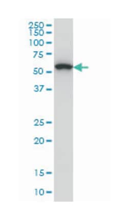 oxidative-stress responsive 1, Mouse, Clone: 3A8, Abnova 100&mu;g; Unlabeled:Antibodies,