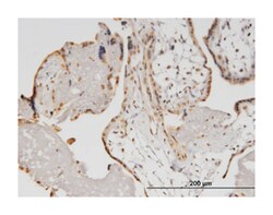 helicase with zinc finger, Mouse, Clone: 5B2, Abnova 100&mu;g; Unlabeled:Antibodies,